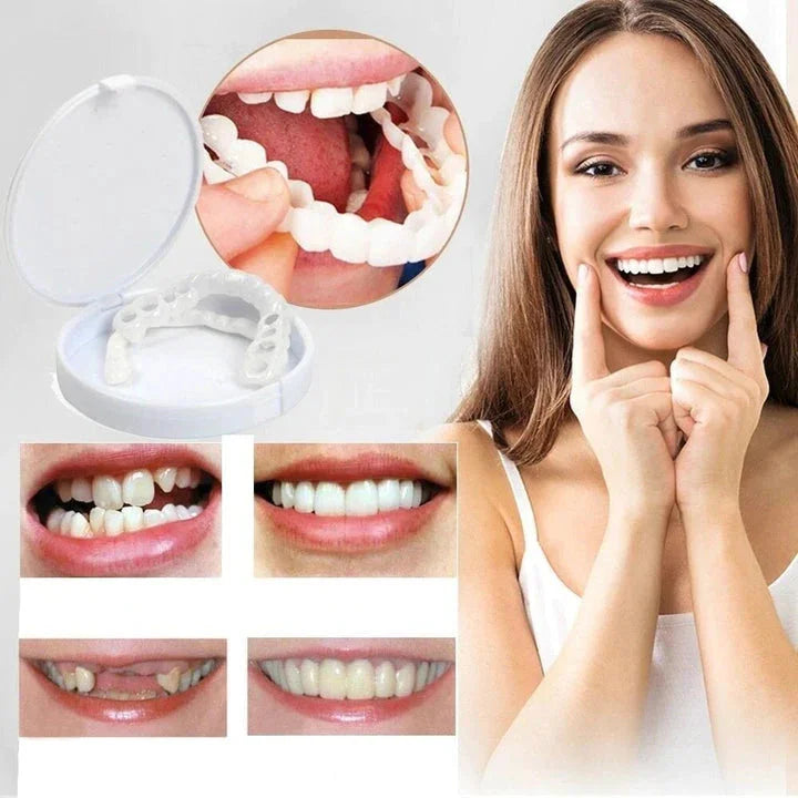 Snap-On Veneers Di NovaBright Creano Un Sorriso Naturale E Veloce Per I Denti Superiori E Inferiori