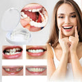 LumaGrin Veneers Rapidi per Denti Superiori e Inferiori