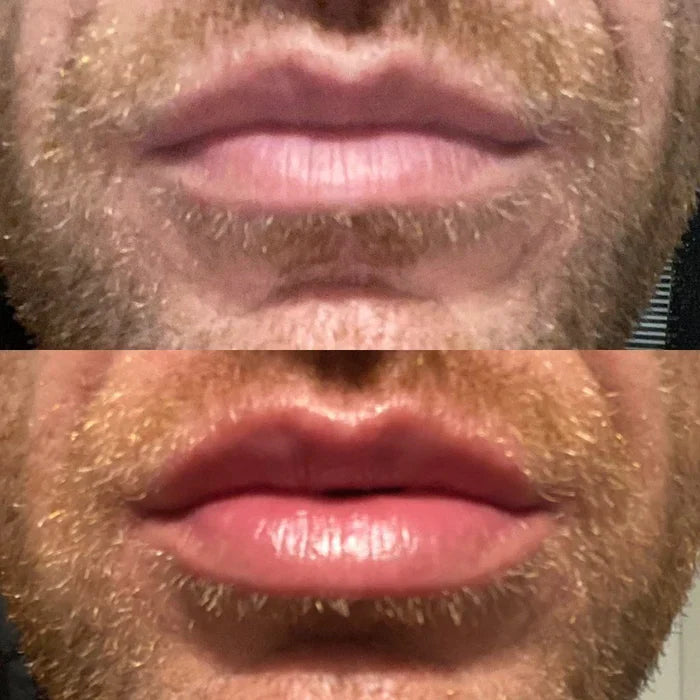 Ottieni labbra più piene rapidamente usando il siero volumizzante per labbra LumaGlow