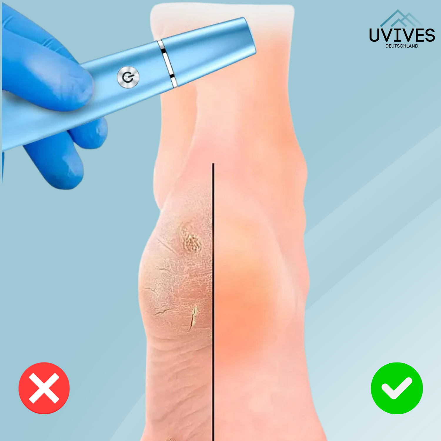 SilkaFeet™ – Piedi lisci e curati senza sforzo