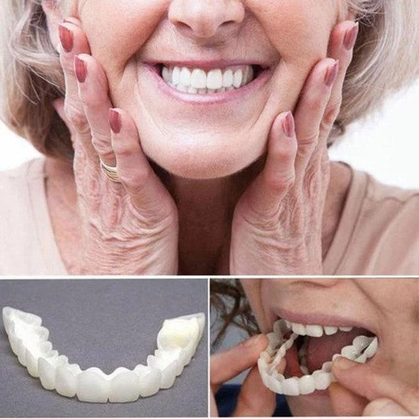 Brehn | Su Smile Veneers (inclusi arcate superiore e inferiore)