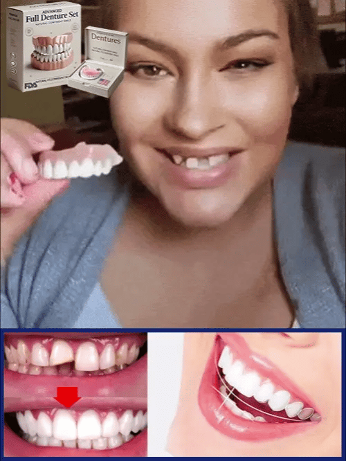 Protesi Dentale Premium | Sorriso Naturale | Vestibilità Confortevole | Riutilizzabile