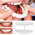 Brehn | Su Smile Veneers (inclusi arcate superiore e inferiore)