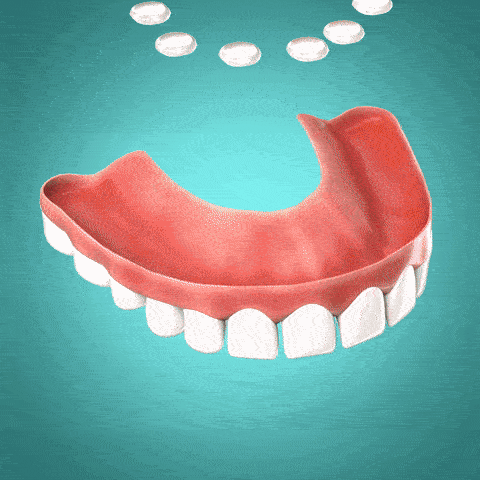 ProthesenPassform™ Adattamento Flessibile e Sicuro