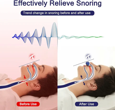 Micro CPAP macchina per apnea notturna per viaggi e anti-russamento - alternativa CPAP