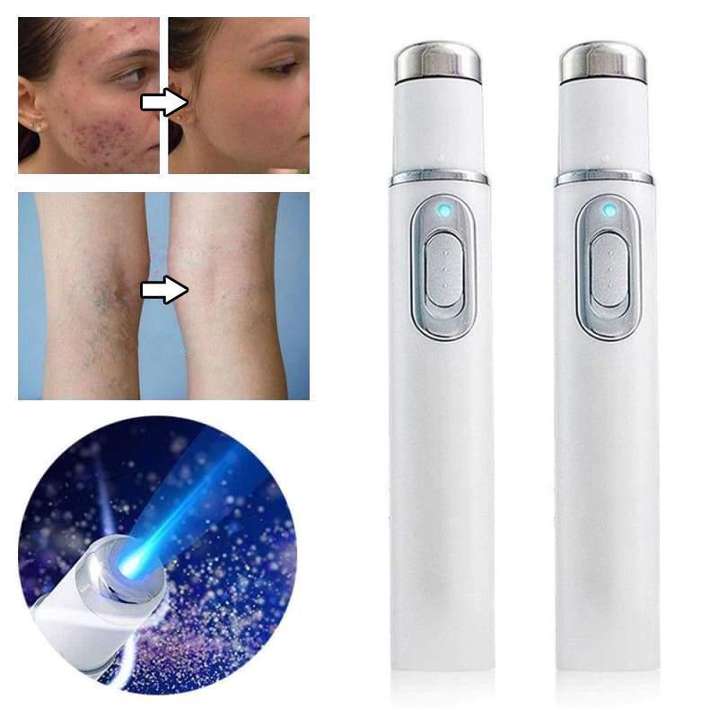 Penna per trattamento laser Blu-Ray per rimuovere l'acne indesiderata