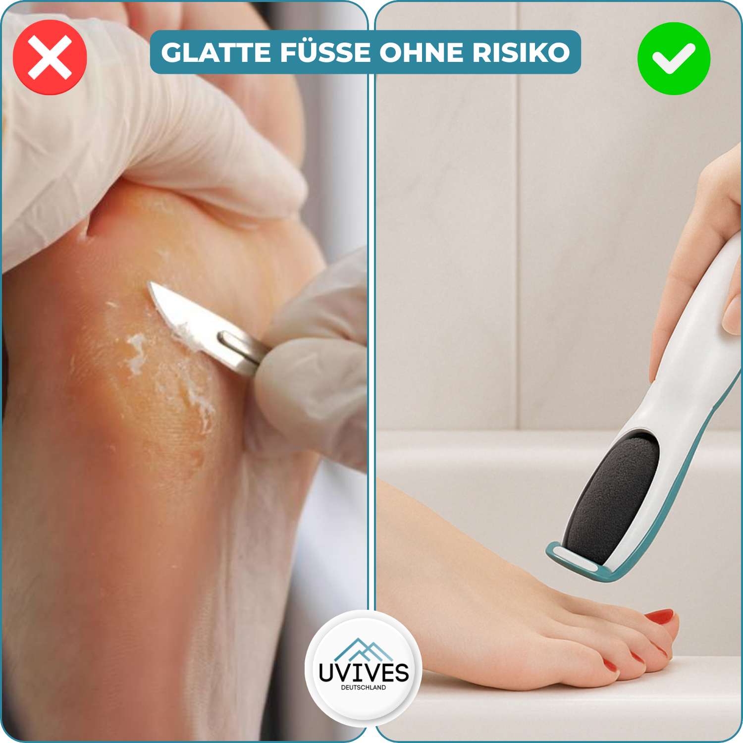 SilkaFeet™ – Piedi lisci e curati senza sforzo