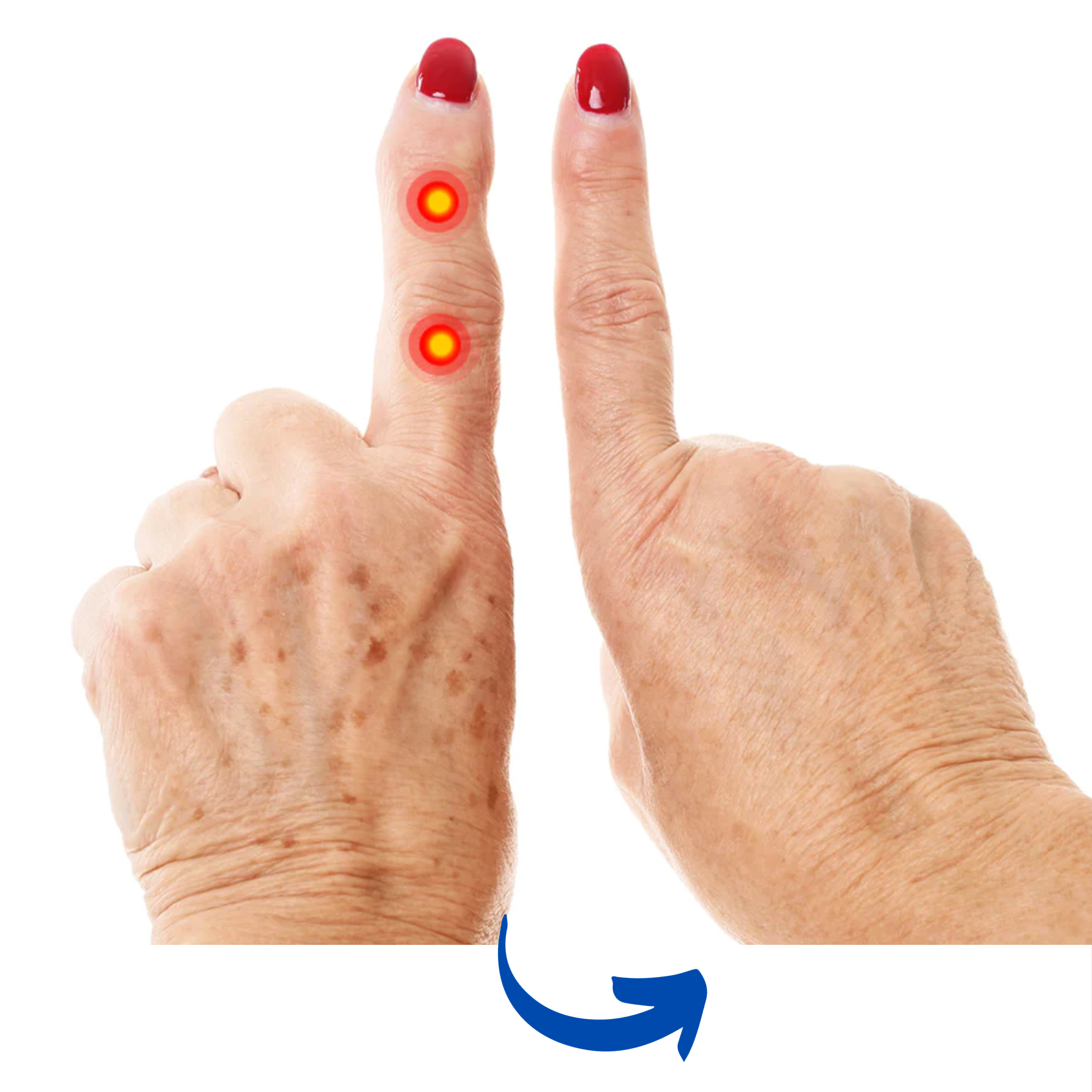 Guanti Terapia Infrarossi ArthroGlow per il Sollievo dal Dolore Artritico