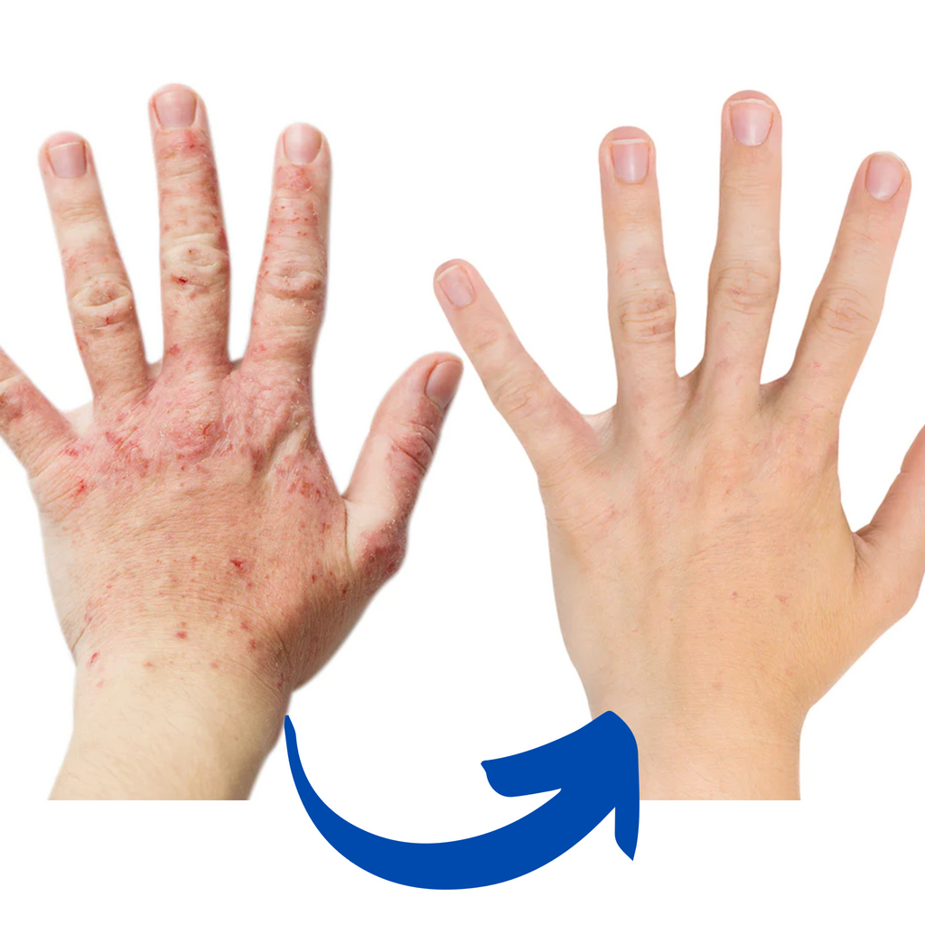 Guanti Terapia Infrarossi ArthroGlow per il Sollievo dal Dolore Artritico