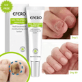 Efero® Gel Riparatore per Unghie: 1 + 2 GRATIS – Offerta Temporanea