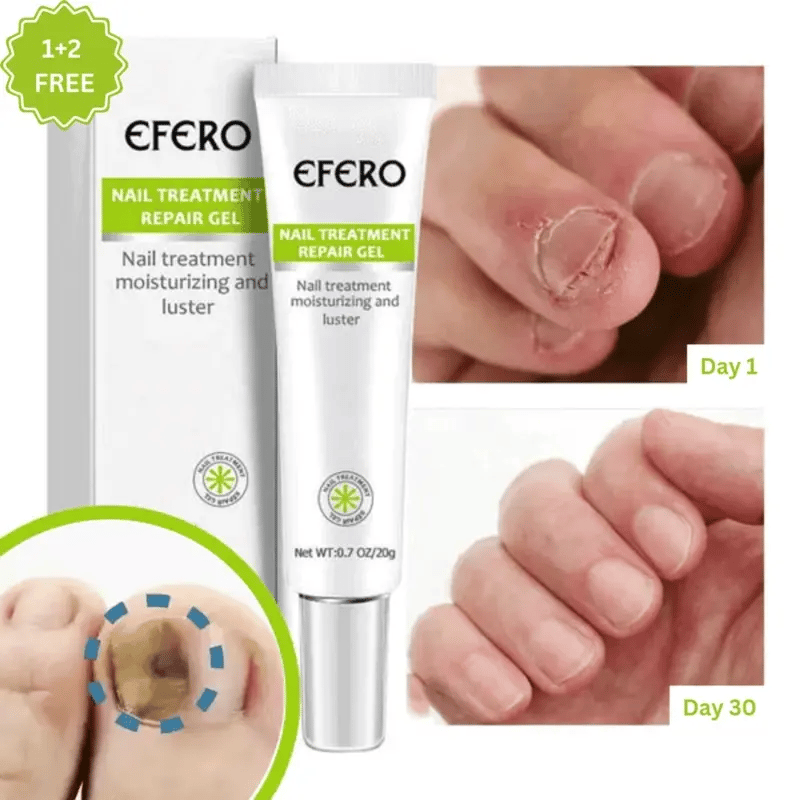 Efero® Gel Riparatore per Unghie: 1 + 2 GRATIS – Offerta Temporanea