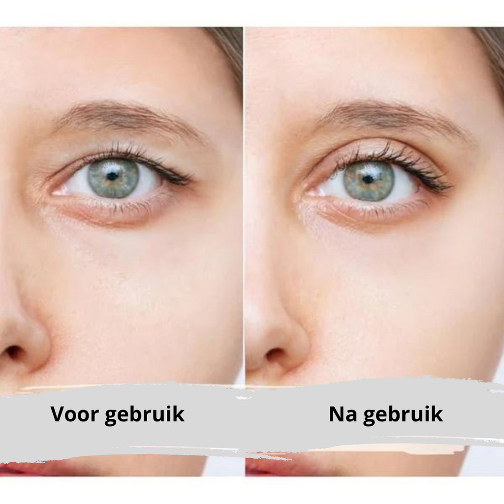 EyePerfection | Nastro per palpebra doppia per palpebra cadente | Unisex