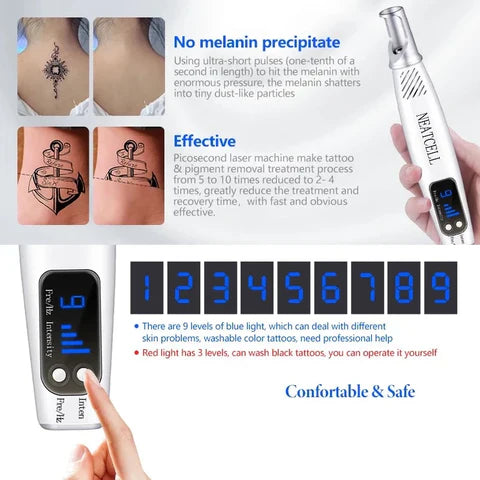 LumiDerm Penna Laser Domestica per Rimozione Tatuaggi, Nei e Lentiggini