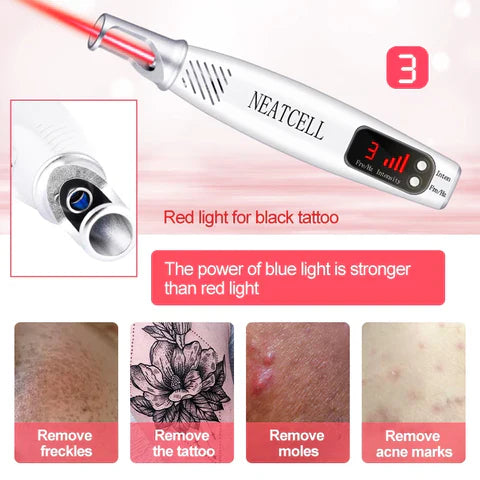 LumiDerm Penna Laser Domestica per Rimozione Tatuaggi, Nei e Lentiggini