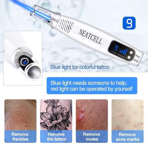LumiDerm Penna Laser Domestica per Rimozione Tatuaggi, Nei e Lentiggini