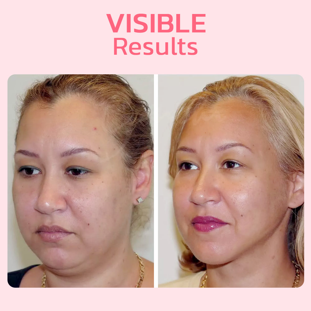 GesichtFormen™ Modellazione Facciale Naturale
