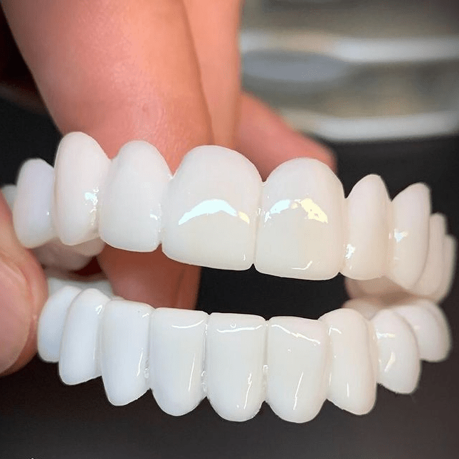 SMILEFLEX – Protesi dentale con lenti dentali bianche