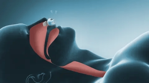 Lumenix Nano Ultra Compatto Aiuto per il Sonno da Viaggio Senza Tubo