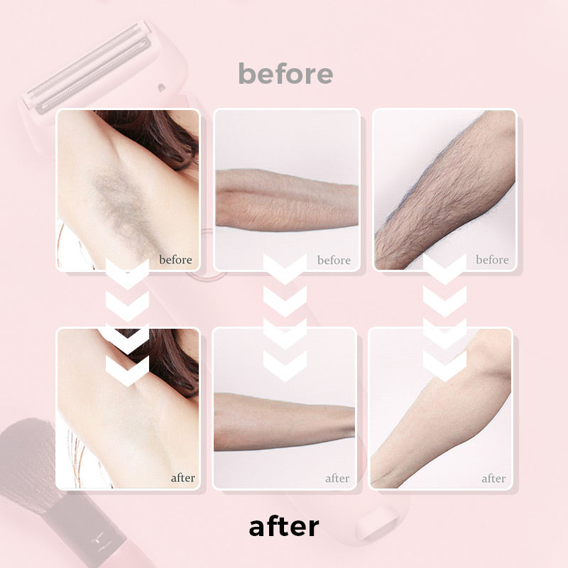 SilkSmooth Rasoio Elettrico | Depilazione senza sforzo con un tocco setoso
