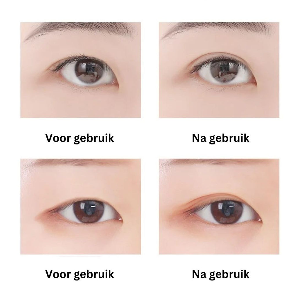 EyePerfection | Nastro per palpebra doppia per palpebra cadente | Unisex