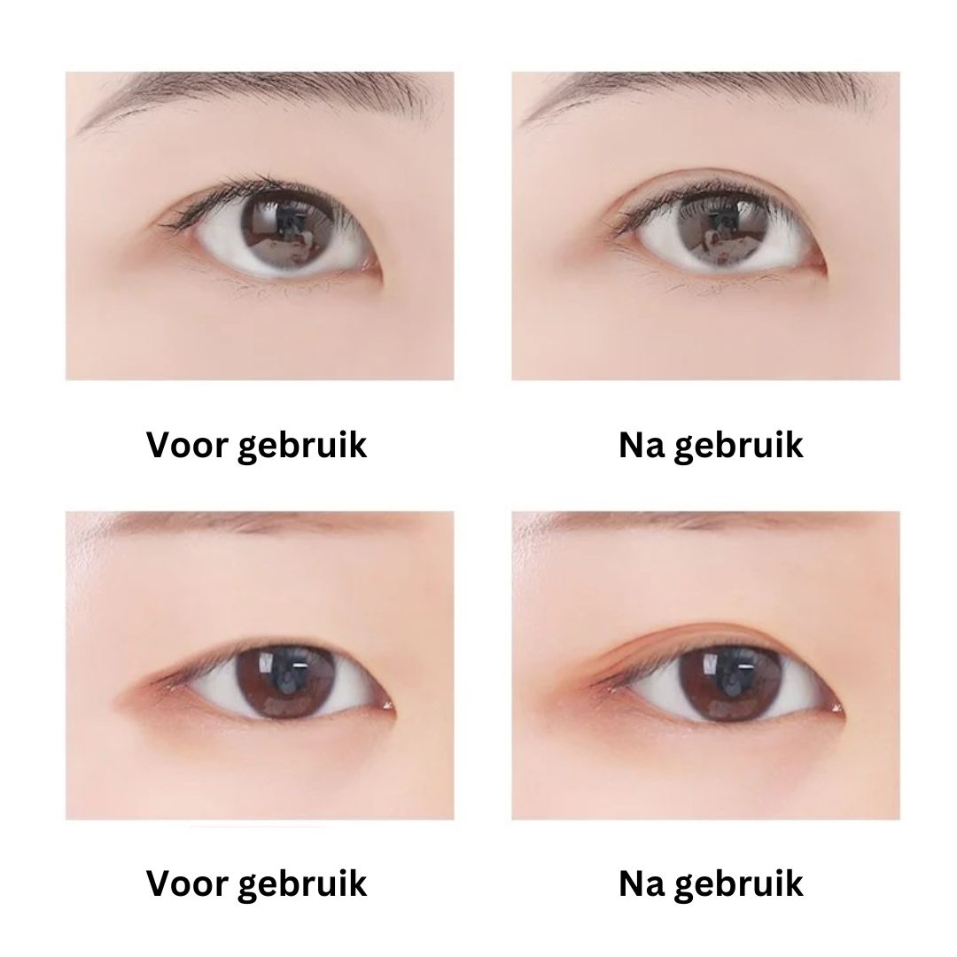 EyePerfection | Nastro per palpebra doppia per palpebra cadente | Unisex