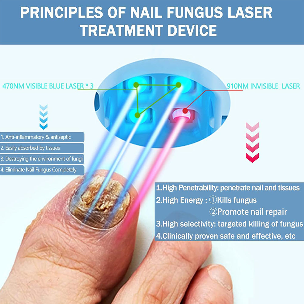 Dispositivo per la Cura delle Unghie a Laser NexaLume da Casa Facile da Usare