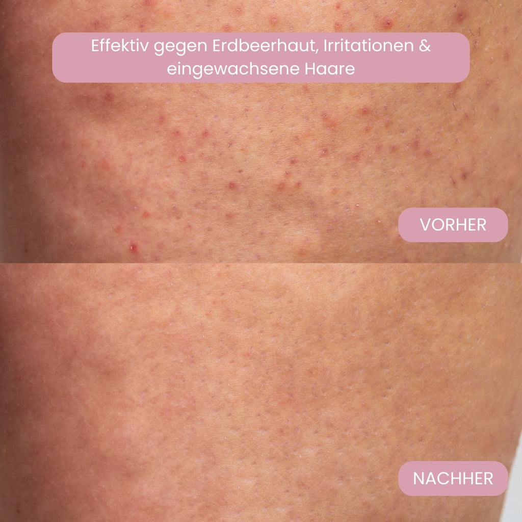 Rasoi per zone intime per donne | Rasoio elettrico per donne per la zona intima | Trimmer per bikini | Femora