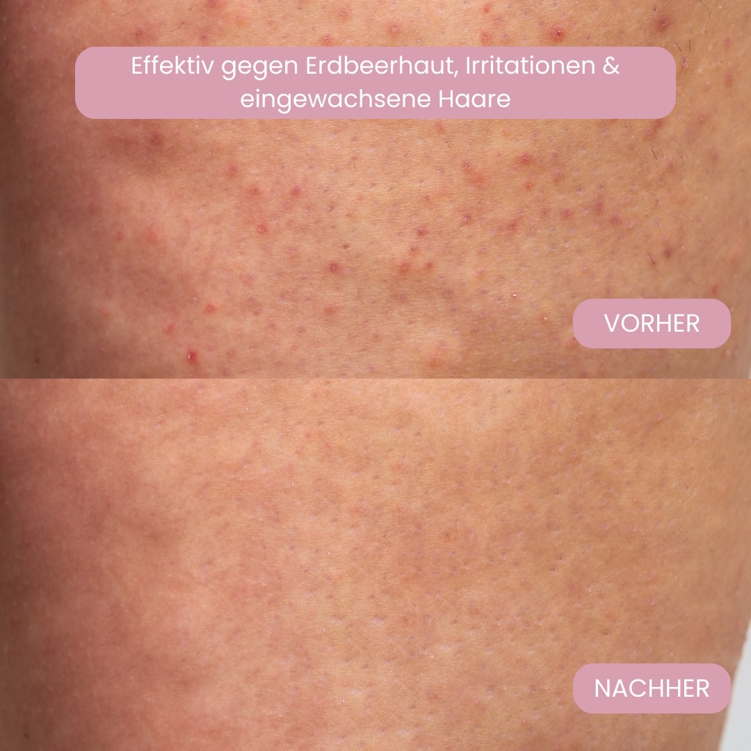 Rasoi per zone intime per donne | Rasoio elettrico per donne per la zona intima | Trimmer per bikini | Femora