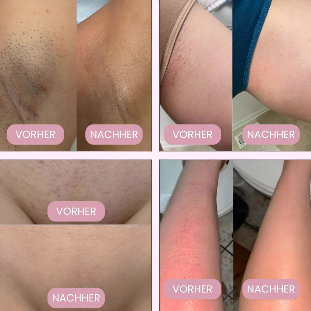 Rasoi per zone intime per donne | Rasoio elettrico per donne per la zona intima | Trimmer per bikini | Femora