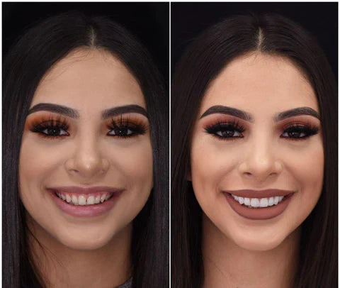 LumaGrin Veneers Rapidi per Denti Superiori e Inferiori