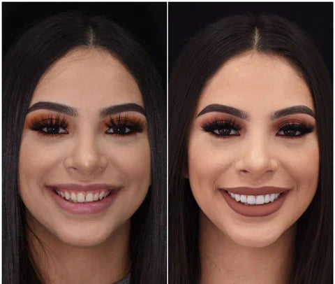 Snap-On Veneers Di NovaBright Creano Un Sorriso Naturale E Veloce Per I Denti Superiori E Inferiori