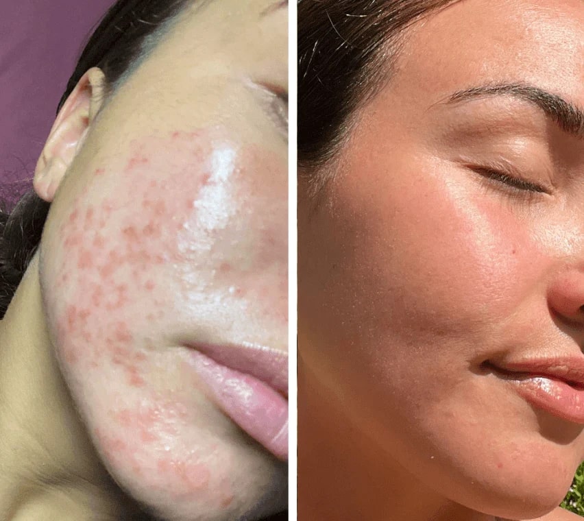 Maschera a Luce Rossa | Maschera LED per il Viso | Terapia della Luce per la Pelle | PelleGlow
