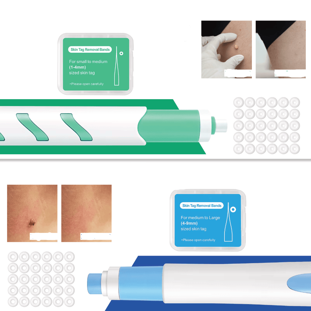 LuxuraCare Rimuovi Verruche Professionale | Soluzione efficace per la rimozione delicata delle verruche peduncolate