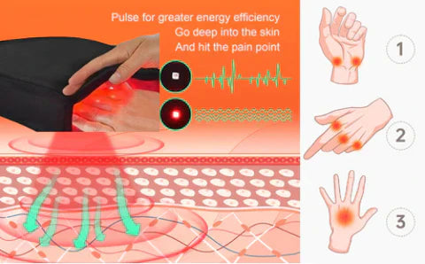 Guanti Terapia Infrarossi ArthroGlow per il Sollievo dal Dolore Artritico